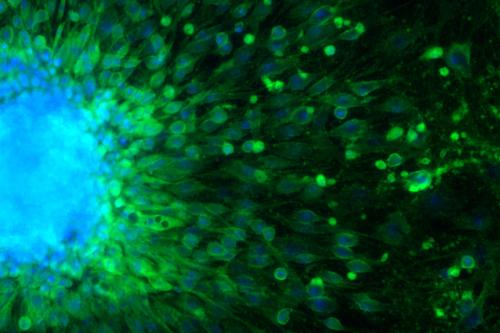 Microscopic image of a embryoid body formed by induced pluripotent stem cells, showing their nuclei (blue) and VE-cadherin (an endothelial cell marker, green).