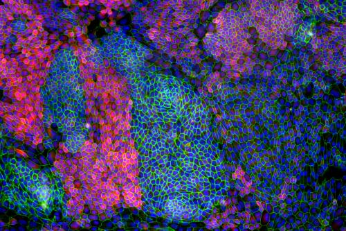 This image captures a retinal pigment epithelium, or RPE, derived from an induced-pluripotent stem cell, or iPSC, line. Image shows cell borders (green), mature RPE-specific marker (red), and cell nuclei (blue) in iPSC-RPE cells in order to confirm the identity of iPSC-derived RPE cells. 