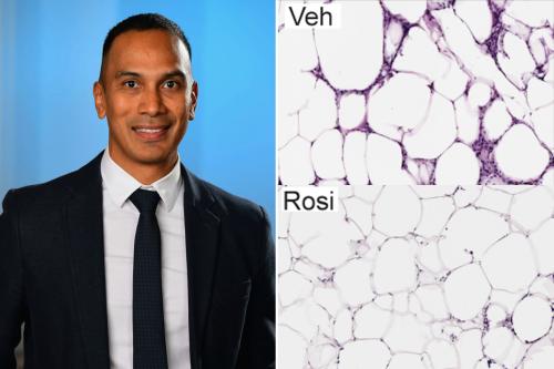 A collage: Clockwise from top right: Fat cells in obese, diabetic mice are larger than those in lean mice; when given rosiglitazone, fat stem cells in mice could produce smaller fat cells; Claudio Villanueva. 