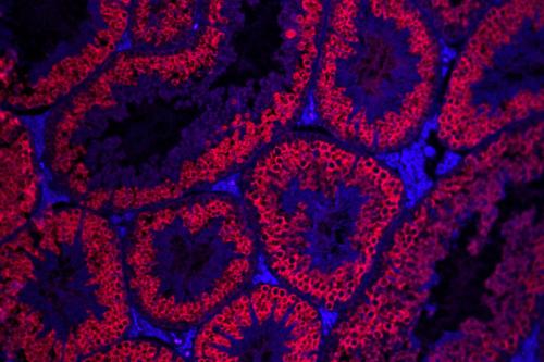 Fluorescent red cross-sections of tubular structures on a blue background.