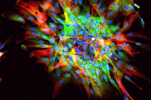 Microscope scar in a dish fibrosis