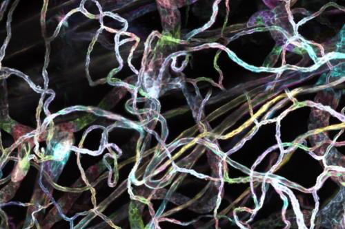 Microscopy image of blood vessel cells.