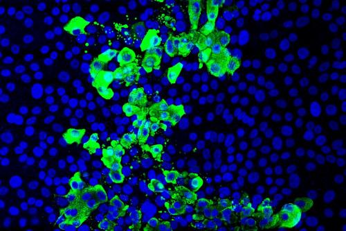 Microscopic images of human stem cell–derived airway tissue models with cell nuclei (blue) and SARS-CoV-2 virus infected cells (green); tissue exposed to cigarette smoke had 2 to 3 times more infected cells than non-exposed tissue.