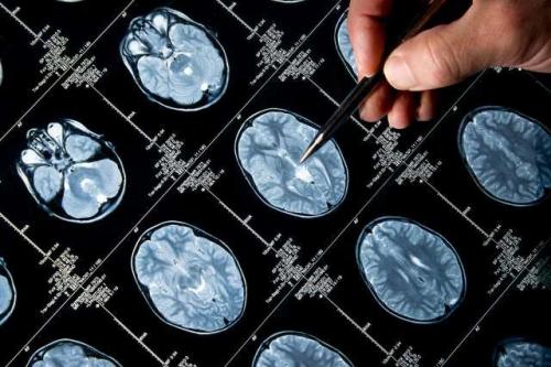 Brain scan images with a hand gesturing.