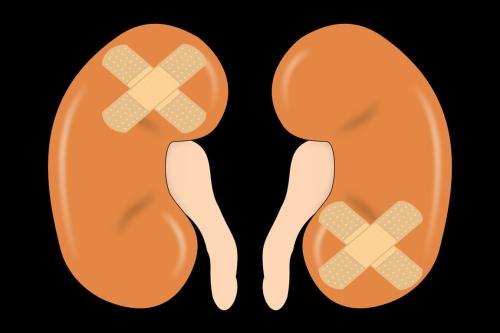 An artistic illustration of two orange kidneys with bandages on them against a solid black background. 