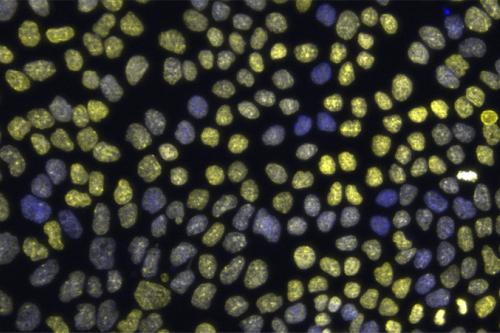 An image showing epithelial chromatin variation, with DNA (blue) and histone marker H3K27me3 (yellow) that represses gene activity