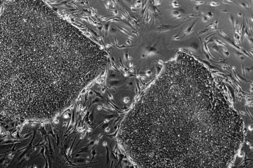 Microscopy image of iPSCs.