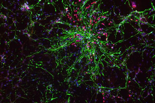 Fluorescence microscopy image showing a dense network of branching astrocytes in green, interspersed with red intermediate progenitor cells against a dark background.