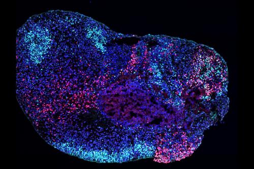 Microscopy image of a human stem cell–derived hippocampal organoid with inhibitory neurons in red