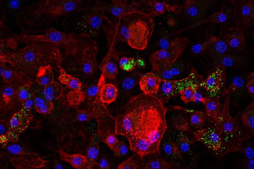 Microscopy image showing senescent macrophages in red and cholesterol-laden lipid droplets – a key driver of senescence – in green. 