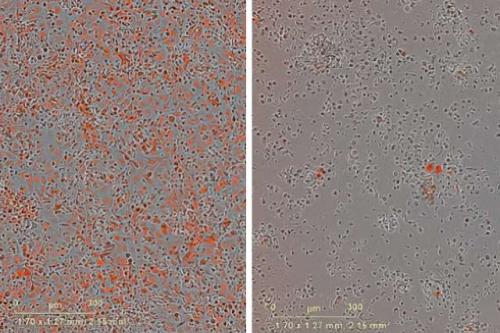 A microscopy image of melanoma cells.
