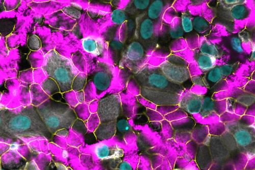 Microscopic image of airway epithelium, showing stem cells (in white) that regenerate and mature into differentiated cells of the airway, including ciliated cells (in fuchsia) to form an impermeable barrier with tight junctions between cells (in green).
