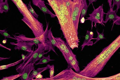 Fluorescence microscopy of muscle stem cells displaying long magenta fibers and bright green oval nuclei.