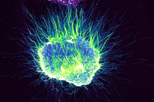 Fluorescence microscopy of a neuron showing a bright green and blue cell body with a dense, radiating network of fine processes.