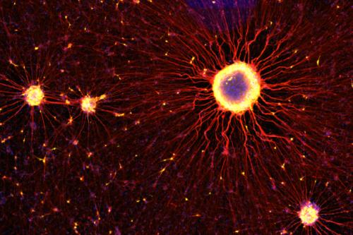 Fluorescence microscopy of neural cells with glowing yellow centers and extensive red, star-like branching processes on a dark background.