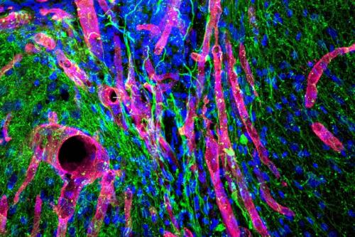 A photomicrograph showing new tissue growing in the stroke cavity in a mouse. Red tubes are blood vessels; green filaments are nerve fibers.