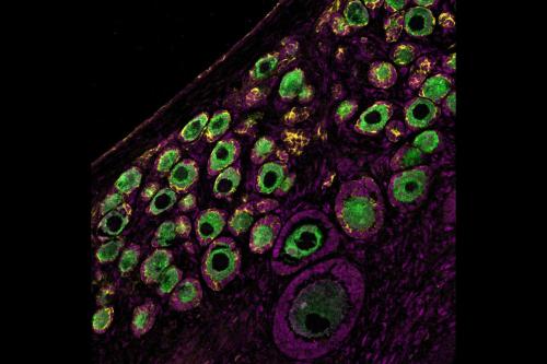 microscopy image of the outer region of the rhesus macaque ovary with the developing egg cells marked by VASA protein (in green) and being surrounded by supporting granulosa cells marked by FOXL2 (in magenta) and KRT19 (in yellow)