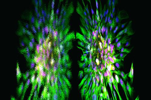 Fluorescence microscopy of tissue showing two large, starburst-like cellular structures with outward-radiating green streaks and dense clusters of pink and blue nuclei at their centers.
