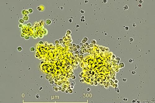 A model of small cell neuroendocrine prostate cancer developed by UCLA scientists.
