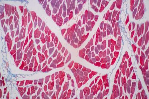 A microscopy image of skeletal muscle tissue stained in shades of pink and red.