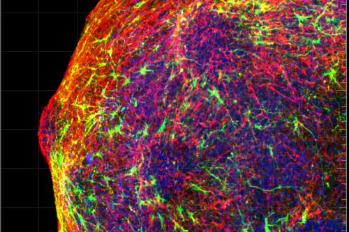 A microscopy image of human stem-cell derived neurons made to form a human cortical sphreoid.