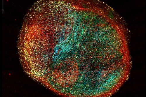 A slice through an organoid of the developing human cortex, labeled for different brain cell types: oligodendrocytes in green, astrocytes in yellow, and neurons in red. 