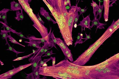 Microscopic image of muscle cells fusing to form proto-muscle structures (myotubes) with the cytoskeletal structures (coral) and nuclei (green) visible