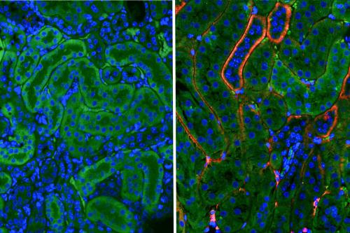 Side-by-side fluorescence microscopy images of injured mouse kidney tissue. The left image, from a mouse treated with the experimental drug AD-NP1, shows bright red fluorescence indicating the antibody has reached its target. The right image, from an untreated mouse, shows no red signal. Blue marks cell nuclei; green is natural tissue coloring.