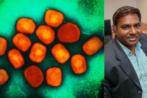 Side-by-side image showing a colorized electron microscope view of monkeypox virus particles and a portrait of UCLA researcher Vaithi Arumugaswami in his office