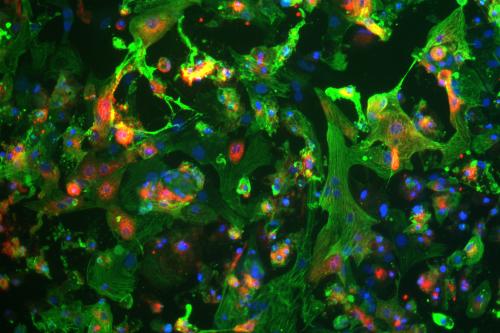 Human induced pluripotent stem cell-derived cardiomyocytes (heart cells) shown in green and blue, are infected by the novel coronavirus SARS-CoV-2 (red)