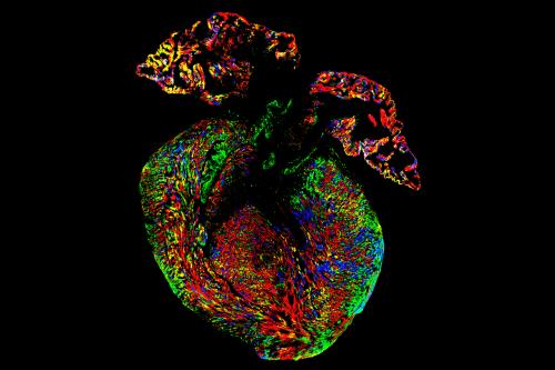 Researchers led by Dr. Reza Ardehali used four different fluorescent-colored proteins to determine the origin of cardiomyocytes in mice.