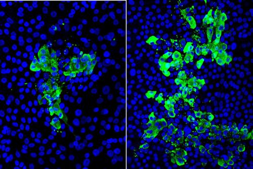 Microscopic images of human stem cell–derived airway tissue models with cell nuclei (blue) and SARS-CoV-2 virus infected cells (green); tissue exposed to cigarette smoke (right) had 2 to 3 times more infected cells than non-exposed tissue (left). 