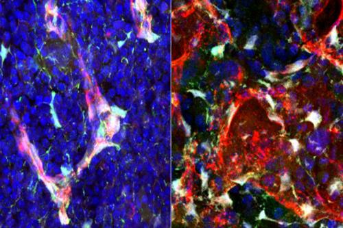 Expression of pleiotrophin (green) in bone marrow blood vessels (red) and stromal cells (white) is shown in normal mice (left) and in mice at 24 hours following irradiation (right).