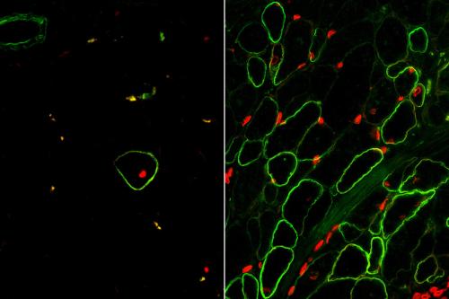 Skeletal muscle cells isolated using the ERBB3 and NGFR surface markers (right) restore human dystrophin (green) after transplantation significantly greater than previous methods (left).