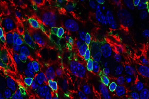 A section of an artificial thymic organoid showing T cells (outlined in green) created from blood stem cells. | UCLA Broad Stem Cell Research Center/Cell Reports