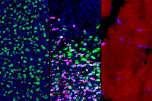 These microscopic images show gene expression in muscle stem and progenitor cells as they mature from early development to adulthood (left to right). As part of this process, the cells switch from actively expressing one key gene (green) to another (violet); this is accompanied by the growth of muscle fibers (red).