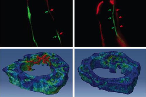 Top row: Double fluorescent bone labeling images of mouse spine, demonstrating greater bone formation with NELL-1 treatment (top right) in comparison to control. Bottom: Computer-simulated images compare bone strength in a mouse spine treated with NELL-1 (bottom right) in comparison to control; red indicates areas at risk for fracture.