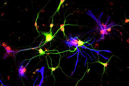 Neurons (in green) producing growth differentiation factor 10 (red), a molecule discovered by UCLA scientists that previously had no known role in the adult brain.