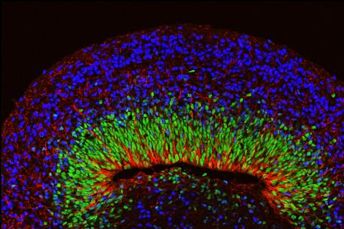 A microscope image of a mini brain organoid showing layered neural tissue and different types of neural cells.