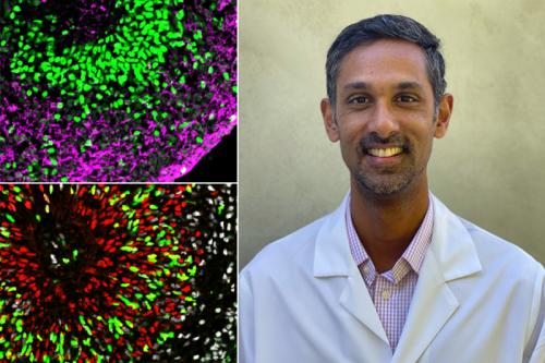 Microscope images of stem cell-derived organoids replicating different parts of the human brain. Dr. Ranmal Samarasinghe