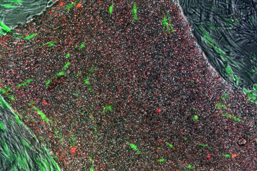 Cell colony with induced pluripotent stem cells stained in red using the TRA method