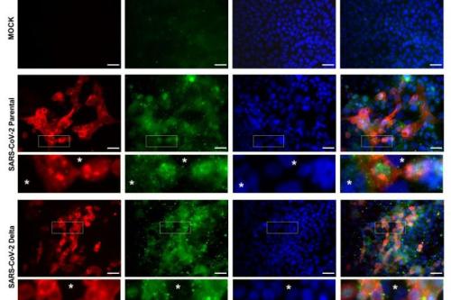 This chart shows levels of SARS-CoV-2 and deactivated YAP (pYAP127) in healthy cultured cells (mock) and cultured cells infected with the original strain of COVID-19 (SARS-CoV-2 Parental) and the Delta strain (SARS-CoV-2 Delta). Asterisks in the insets indicate uninfected cells.