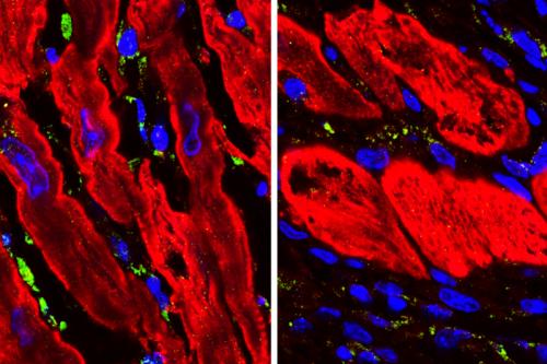Microscopic images showing heart tissue in mice (with cardiac muscle cells in red) after a heart attack. Untreated tissue (left) shows more DNA damage (green) than tissue that has been treated with an experimental drug (right).