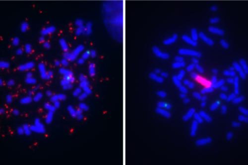 Melanoma cell lines can harbor BRAF gene amplification (red signal) in two remarkably different modes, as extrachromosomal DNA (ecDNA) (left) and as an intrachromosomal homogeneously staining region (HSR) (right)