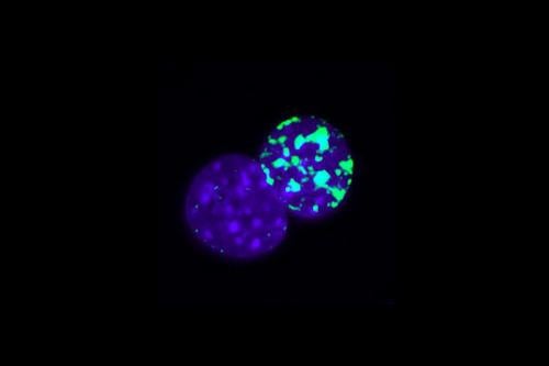 Immunoflurescence staining shows the asymmetric chromatin structure during cell reprogramming. | Credit: Yang Song
