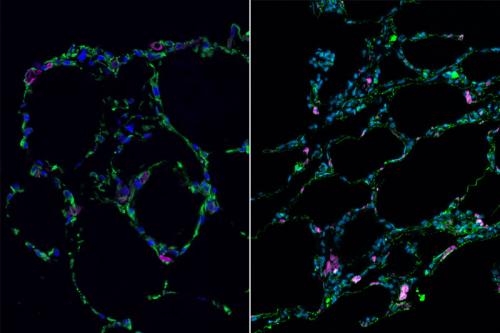 3-D bioengineered lung-like tissue (left) resembles adult human lung (right).