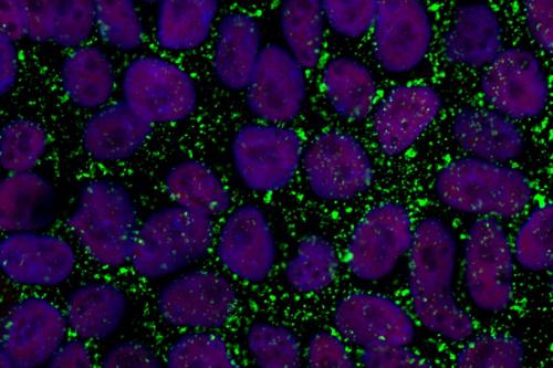 Primed human embryonic stem cells (purple) surrounded by a stem cell surface marker (green), which would be missing in naïve embryonic stem cells.