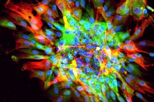 Microscopic image of scarring in a dish, showing evidence of fibrosis (red, green) and nuclei of all cells (blue).