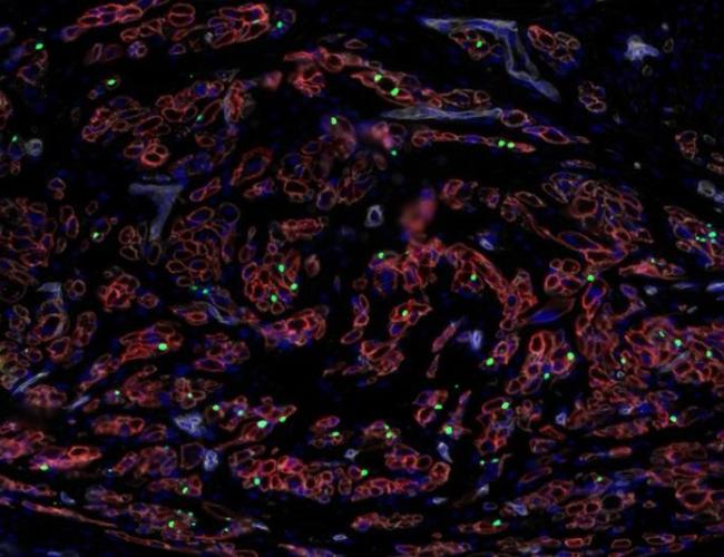 Lab-grown stem cells into muscle progenitor cells (green) and growing muscle fibers (red)