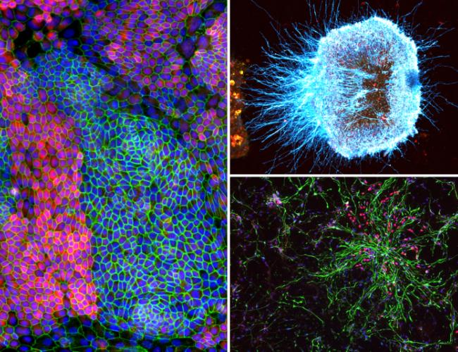 a collage of microscopy images